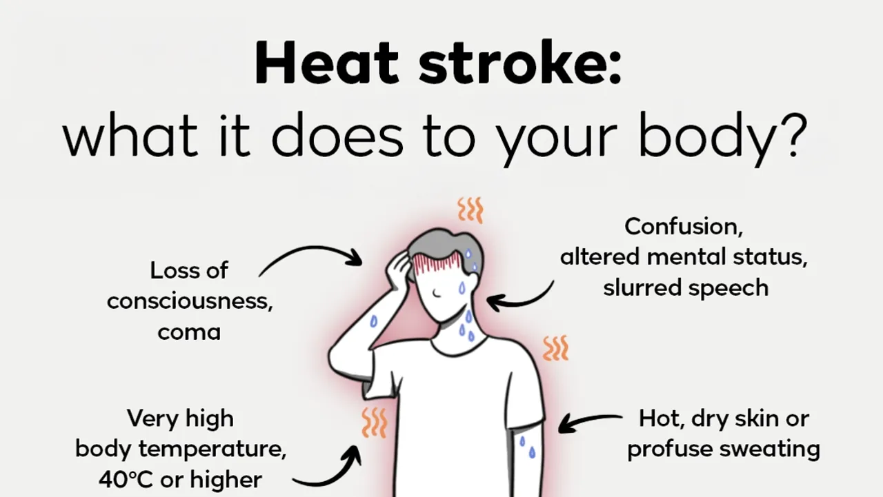 Heat stroke